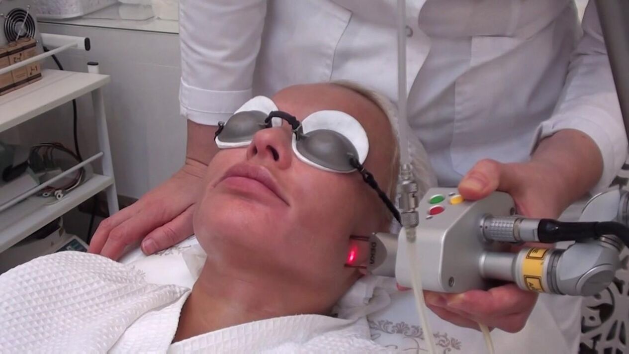 العلاج بأشعة الليزر على المناطق التي تعاني من مشاكل في جلد الوجه