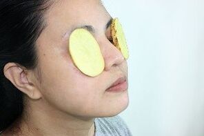 استخدام البطاطس لتجديد شباب حول العينين
